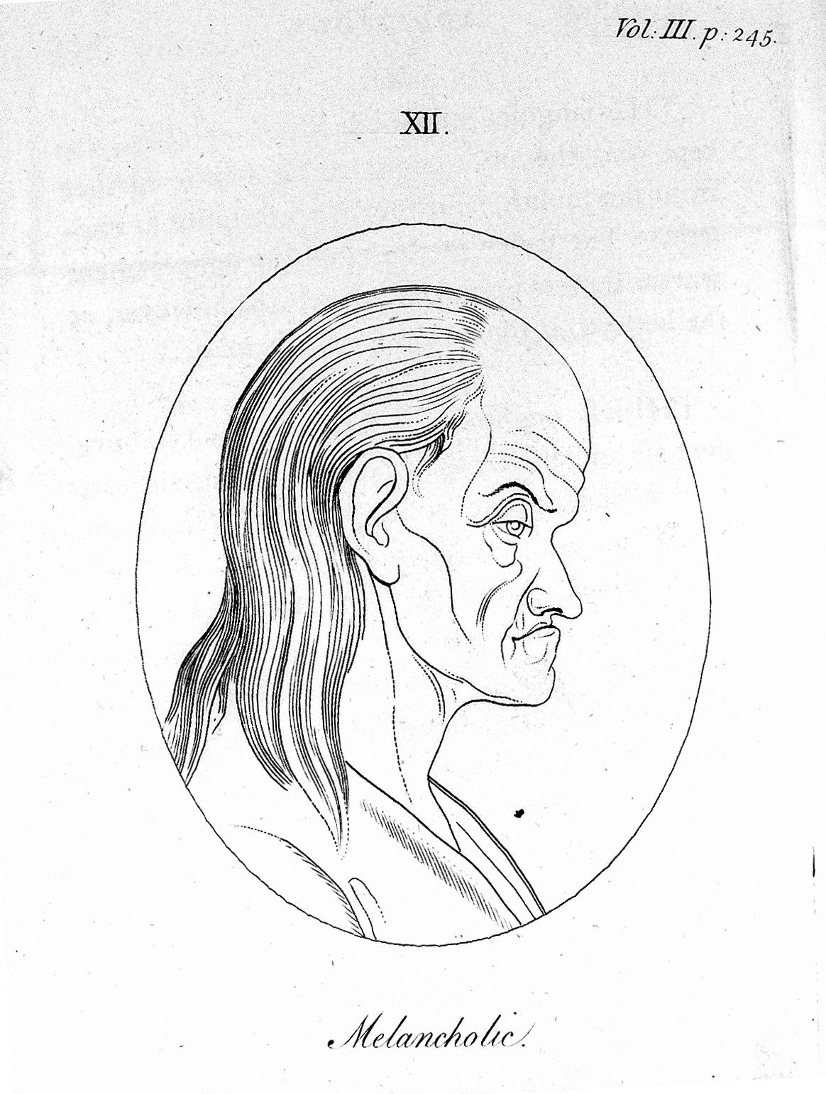 Engraved profile portrait plate labeled 'Melancholic' from the English edition of Lavater's Physiognomische Fragmente/Essays on Physiognomy, showing an oval-framed head-and-shoulders silhouette used to claim temperament could be read from facial features.